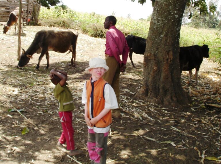 Albinos:tortured by the sun and hunted in the shade